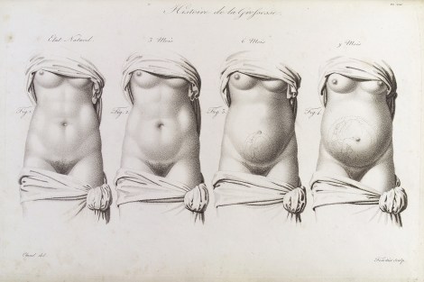Stages in pregnancy as illustrated in the 19th Century medical text Nouvelles démonstrations d'accouchemens, via Wellcome Images